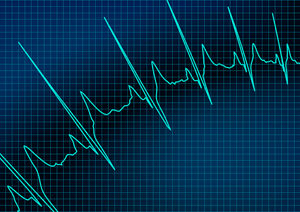 Heart Rate Monitoring Equipment