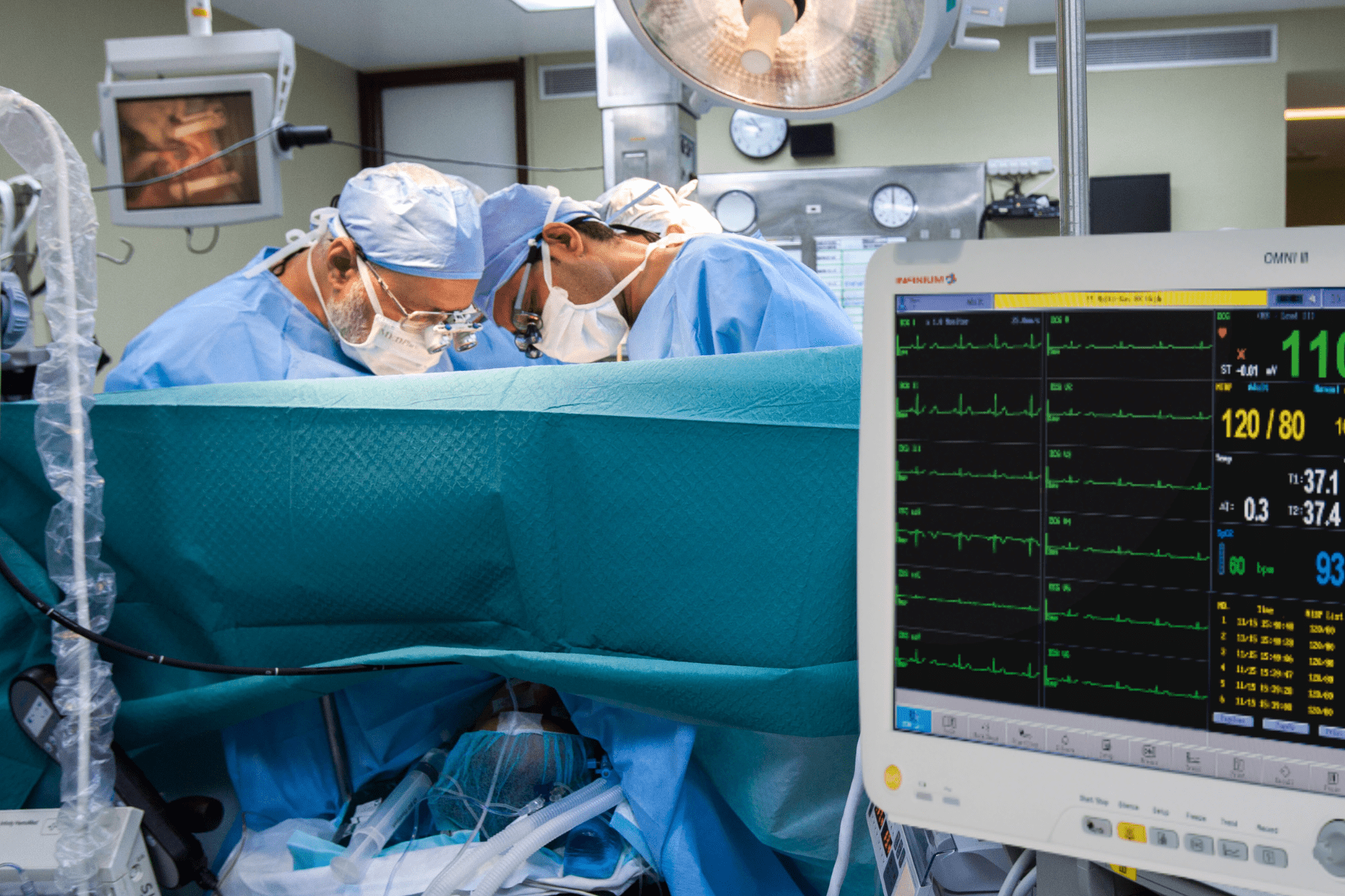 Choosing a Patient Monitoring System