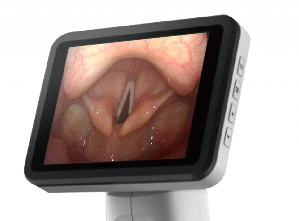 laryngoscope with video screen
