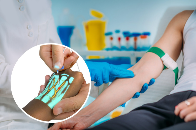 Complete Guide to Medical Vein Finder Technology