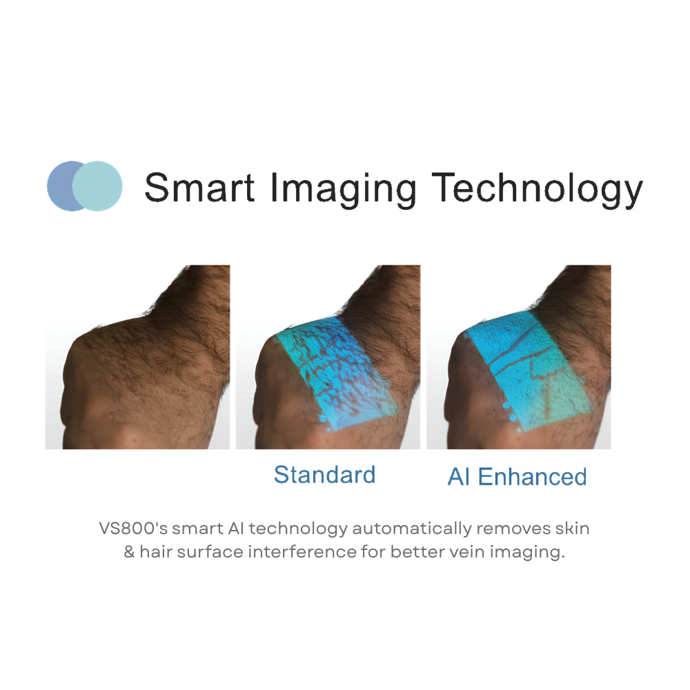 VS800 Vein Finder with Smart Imaging