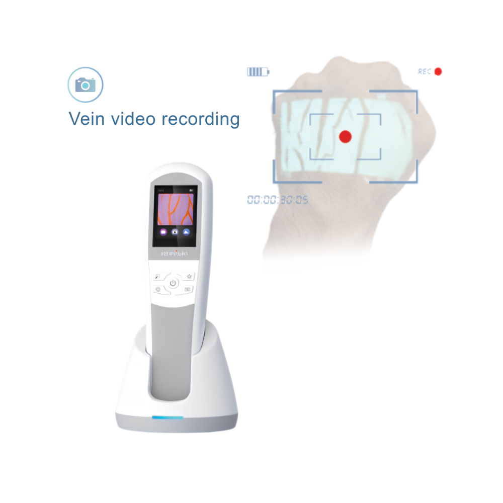 VS800 Vein Video Recording