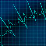 Cardiac Monitors