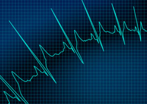 Patient Monitoring Devices Patient Monitoring Devices